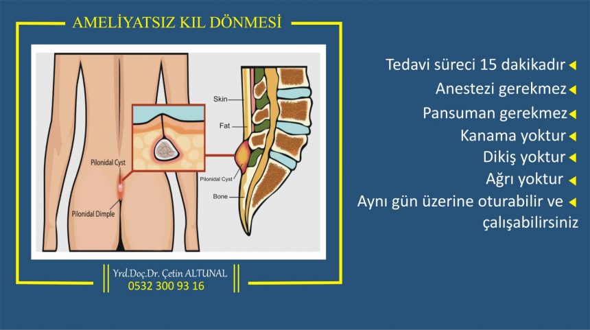 intem hisse türkçe maya dersleri