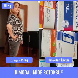 bimodal-mide-botoksu-once-sonra-1