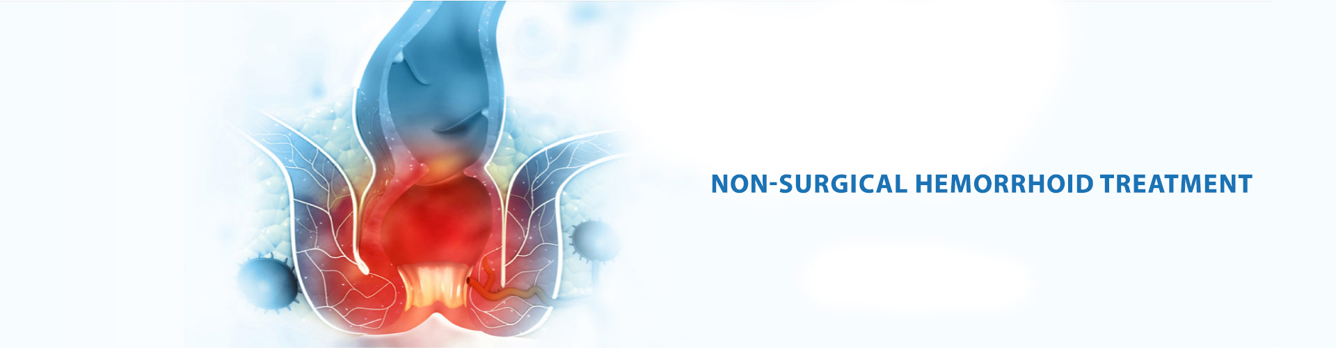 hemorrhoid treatment slider